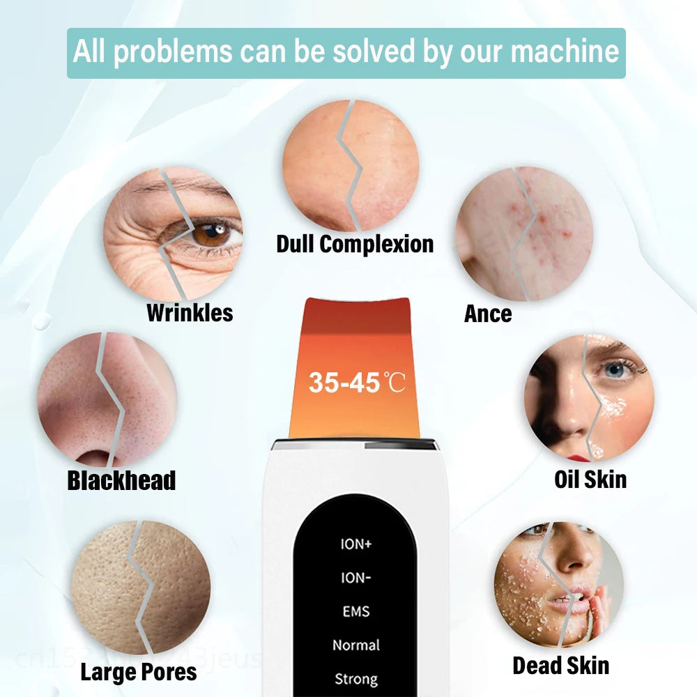 Peel Ultrasonic Skin Scrubber