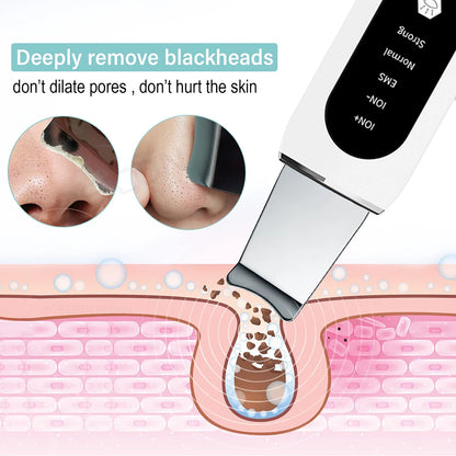 Peel Ultrasonic Skin Scrubber