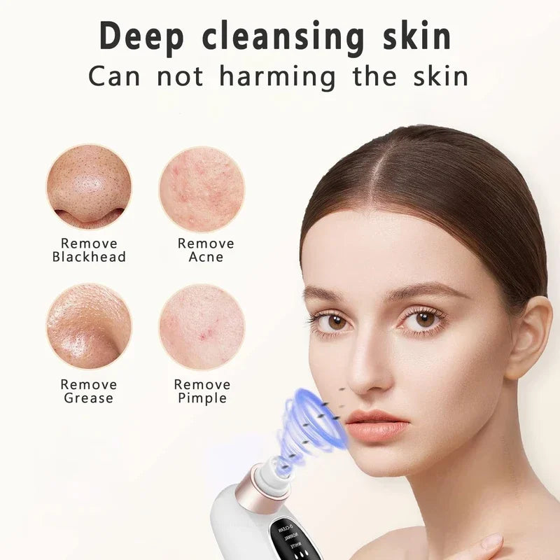 Pore Clean Blackhead Vacuum