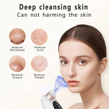 Pore Clean Blackhead Vacuum