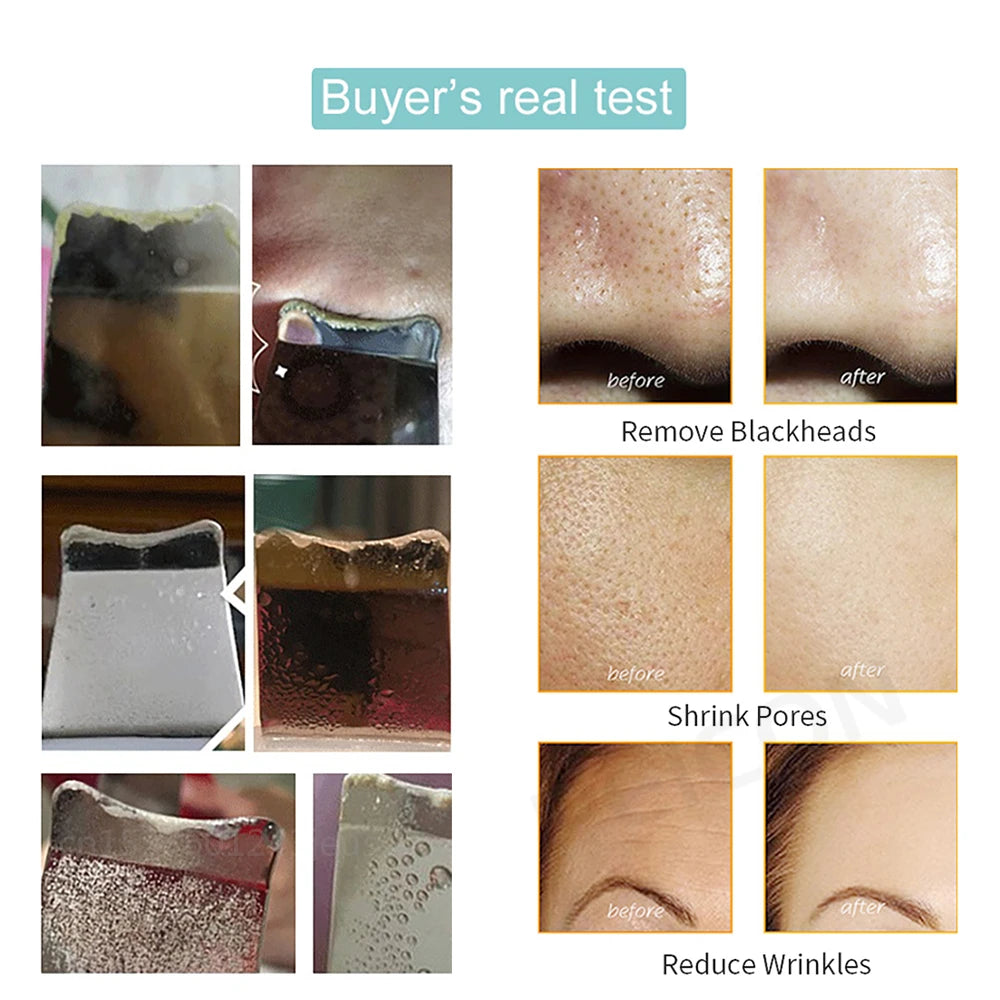 Peel Ultrasonic Skin Scrubber
