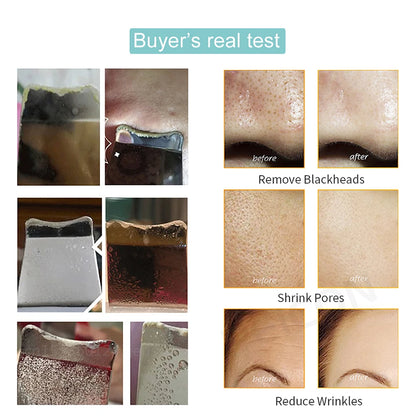 Peel Ultrasonic Skin Scrubber