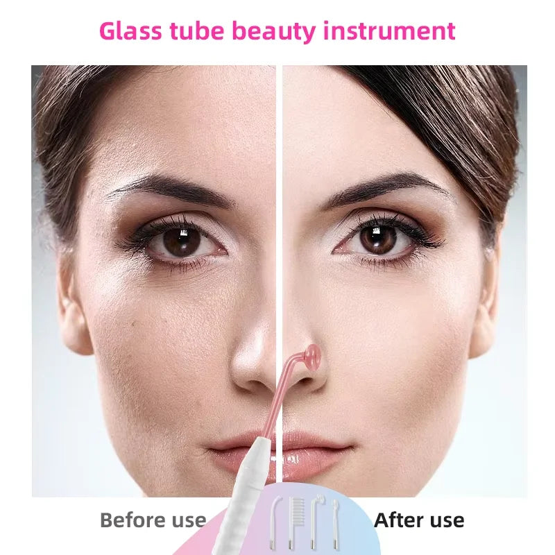 Spark High-Frequency Skin Wand