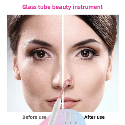 Spark High-Frequency Skin Wand
