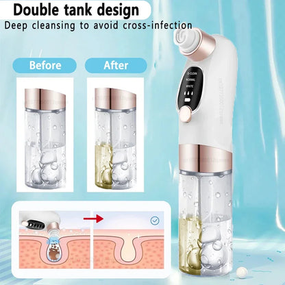 Pore Clean Blackhead Vacuum