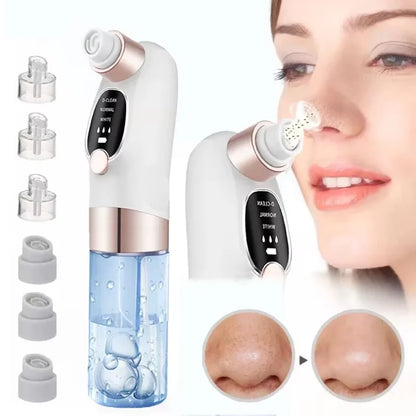 Pore Clean Blackhead Vacuum