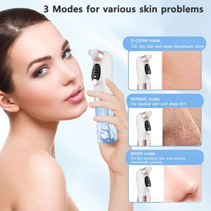 Pore Clean Blackhead Vacuum